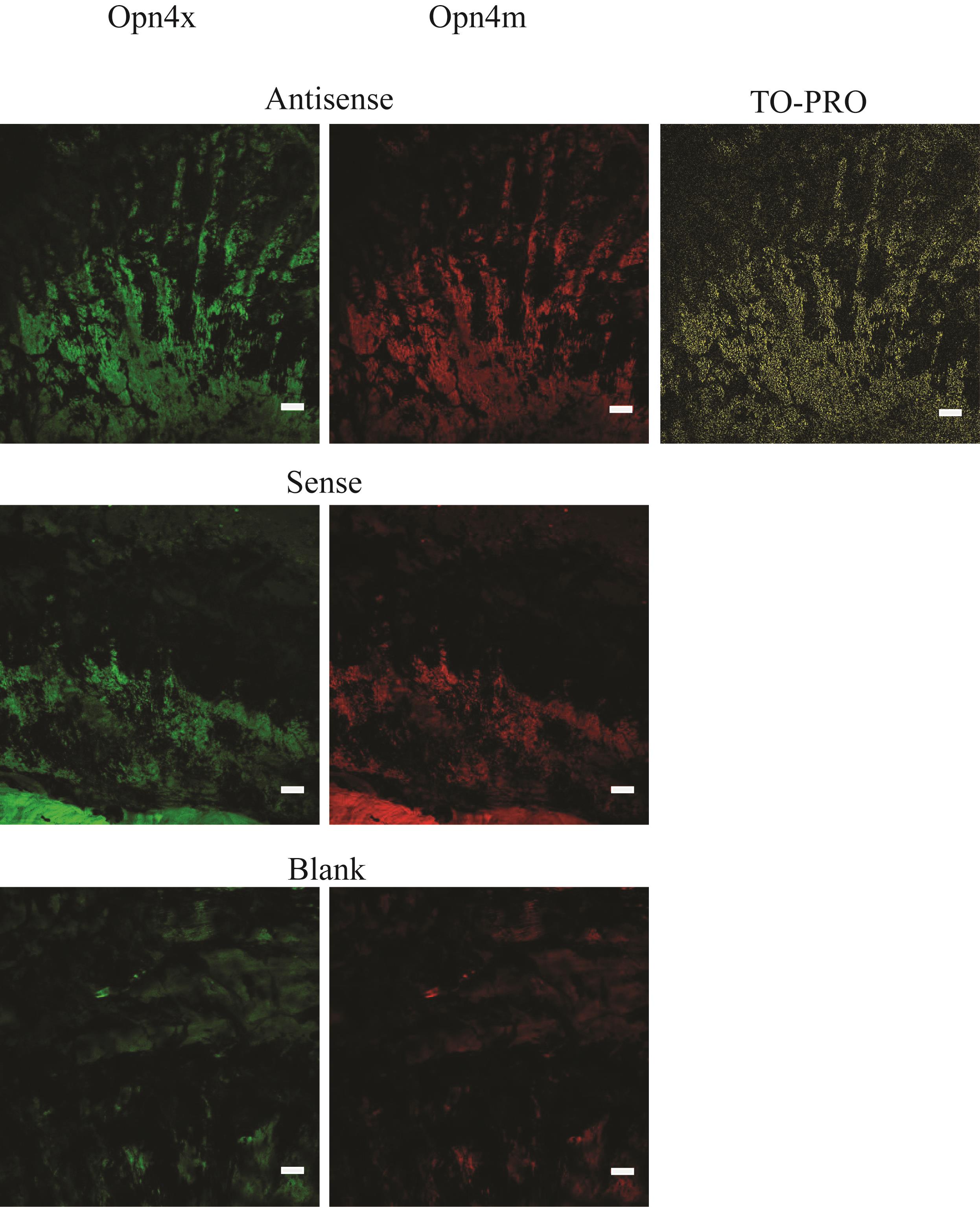 Figure 3: Fluorescence image yielded after non-specific binding and tissue auto-fluorescence was accounted for in the sense and antisense probes