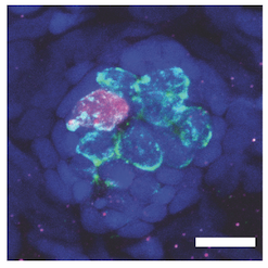 A collection of cells with one cell showing a magenta label indicating it is undergoing apoptosis.