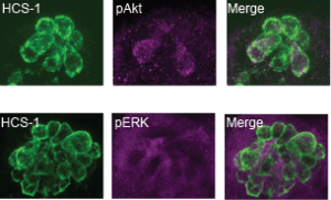 A series of images of clusters of cells. On the left are clusters of green hair cells. In the middle are labels showing either pAkt which overlaps with the green hair cells or pERK which does not overlap with the hair cells. On the right are merged images. 